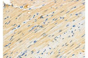 ABIN6264522 and ABIN6279752 at 1/100 staining Rat heart tissue by IHC-P.