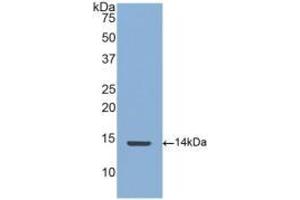 WB of Protein Standard: different control antibodies against Highly purified E. (CTGF CLIA Kit)