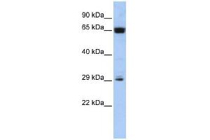 MGC45491 antibody used at 1 ug/ml to detect target protein. (MGC45491 (Middle Region) 抗体)