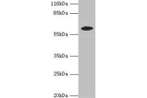 Western blot All lanes: EPHX2 antibody at 2 μg/mL + MCF-7 whole cell lysate Secondary Goat polyclonal to rabbit IgG at 1/10000 dilution Predicted band size: 63, 58, 56 kDa Observed band size: 58 kDa (EPHX2 抗体  (AA 1-555))