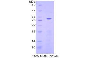 SDS-PAGE analysis of Human Neurofibromin 2 Protein. (Merlin 蛋白)