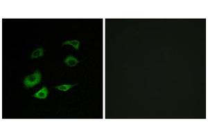 Immunofluorescence analysis of HepG2 cells, using Cyclosome 1 antibody. (APC1 抗体  (Internal Region))
