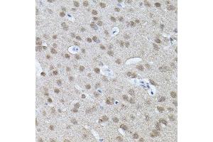 Immunohistochemistry of paraffin-embedded mouse brain using RNF166 antibody. (RNF166 抗体)