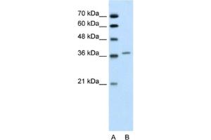 Western Blotting (WB) image for anti-Aminolevulinate Dehydratase (ALAD) antibody (ABIN2462446) (ALAD 抗体)