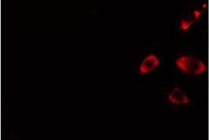 ABIN6274440 staining HuvEc cells by IF/ICC. (RIN3 抗体  (Internal Region))