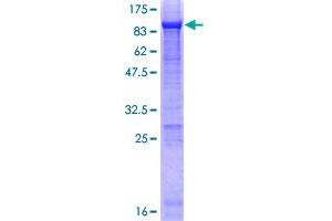 Image no. 1 for alpha-Fetoprotein (AFP) (AA 1-609) protein (GST tag) (ABIN1344536)