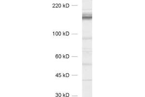Western Blotting (WB) image for anti-CAP-GLY Domain Containing Linker Protein 1 (CLIP1) (AA 1283-1438) antibody (ABIN1742487) (CLIP1 抗体  (AA 1283-1438))