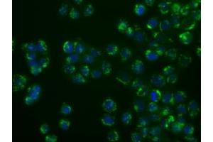 Image no. 2 for anti-Nucleotide Exchange Factor SIL1 (SIL1) antibody (ABIN1496810) (SIL1 抗体)