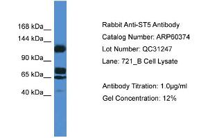 Western Blotting (WB) image for anti-Suppression of Tumorigenicity 5 (ST5) (Middle Region) antibody (ABIN2788427) (ST5 抗体  (Middle Region))