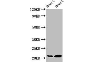 Western Blot Positive WB detected in: Rat heart tissue, Mouse heart tissue All lanes: CRYAB antibody at 2 μg/mL Secondary Goat polyclonal to rabbit IgG at 1/50000 dilution Predicted band size: 21 kDa Observed band size: 21 kDa
