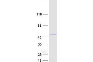 Western Blotting (WB) image for Glycosyltransferase-Like Domain Containing 1 (GTDC1) (Transcript Variant 2) protein (Myc-DYKDDDDK Tag) (ABIN2722300)