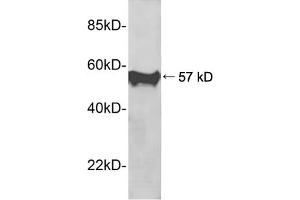 Western blot analysis of recombinant human PIN1 protein using 1 µg/mL Rabbit Anti-PIN1 Polyclonal Antibody (ABIN398689) The signal was developed with IRDyeTM 800 Conjugated Goat Anti-Rabbit IgG (PIN1 抗体  (AA 50-100))