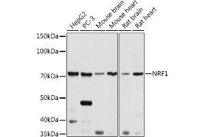Western blot analysis of extracts of various cell lines, using NRF1 antibody (ABIN6128358, ABIN6144851, ABIN6144853 and ABIN6221193) at 1:1000 dilution. (NRF1 抗体  (AA 240-449))