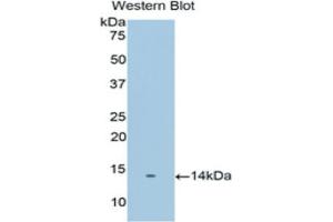 Western blot analysis of the recombinant protein. (PSCA 抗体  (AA 22-123))