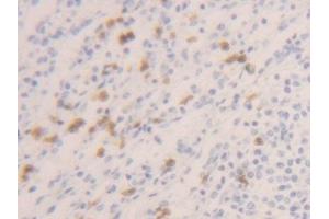 Detection of CASP1 in Human Spleen Tissue using Polyclonal Antibody to Caspase 1 (CASP1) (Caspase 1 抗体  (AA 120-297))