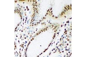 Immunohistochemistry (IHC) image for anti-TAR DNA Binding Protein (TARDBP) antibody (ABIN7308400) (TARDBP 抗体)