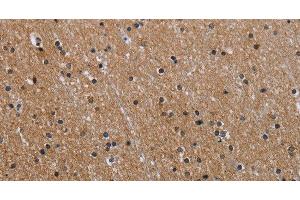 Immunohistochemistry of paraffin-embedded Human brain using GAB2 Polyclonal Antibody at dilution of 1:40 (GAB2 抗体)