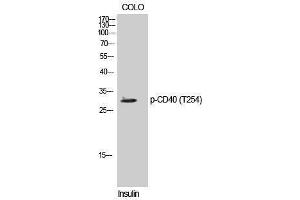 Western Blotting (WB) image for anti-CD40 (CD40) (pThr254) antibody (ABIN3182275) (CD40 抗体  (pThr254))