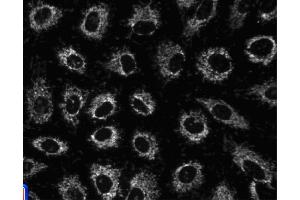 Immunofluorescent staining of A549 (ATCC CCL-185) cells. (HSPD1 抗体)