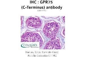 Image no. 2 for anti-G Protein-Coupled Receptor 75 (GPR75) (C-Term) antibody (ABIN1735162)