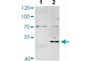 Western blot analysis of Lane 1: Untreated Jurkat cells, Lane 2: Starvation treated Jurkat cells with MAX (phospho S11) polyclonal antibody  at 1:500-1:2000 dilution. (MAX 抗体  (pSer11))