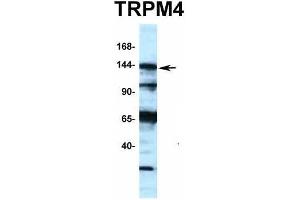 Western Blotting (WB) image for anti-Transient Receptor Potential Cation Channel, Subfamily M, Member 4 (TRPM4) (N-Term) antibody (ABIN2776221)