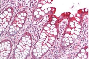 Immunohistochemistry (IHC) image for anti-Protein Interacting With Protein Kinase C, alpha 1 (PICK1) (Internal Region) antibody (ABIN185725)