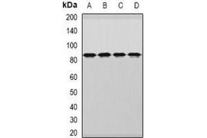Western blot analysis of DDX1 expression in MCF7 (A), HepG2 (B), mouse brain (C), rat brain (D) whole cell lysates. (DDX1 抗体)
