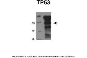 DU145 cells were lysed in IP lysis buffer (20mM HEPES, 1% Triton X-100, 150mM NaCl, 1mMEDTA, 1mM EGTA, 100mM NaF, 10mM Na4P2O7, 1mM Na3VO4, 0. (p53 抗体  (N-Term))