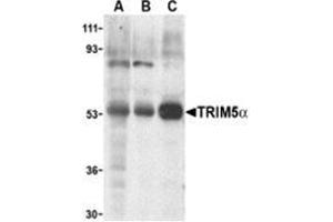 Western blot analysis of TRIM5 alpha expression in human stomach (A), thymus (B), and uterus (C) cell lysate with this product at 2 μg /ml. (TRIM5 抗体  (Isoform alpha, Middle Region))