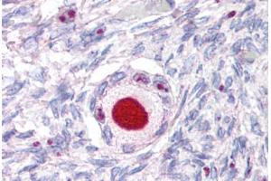 Anti-NR5A1 antibody  ABIN1049145 IHC staining of human ovary. (NR5A1 抗体  (Internal Region))