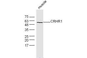 Mouse muscle lysates probed with CRHR1 Polyclonal Antibody, Unconjugated  at 1:300 dilution and 4˚C overnight incubation. (CRHR1 抗体  (AA 55-150))