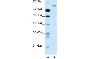 WB Suggested Anti-TRIM28  Antibody Titration: 1. (KAP1 抗体  (C-Term))