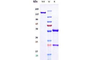 Anti-IL-12b Reference Antibody (ebdarokimab) on SDS-PAGE under reducing (R) condition. (Recombinant IL12B (Ebdarokimab Biosimilar) 抗体)