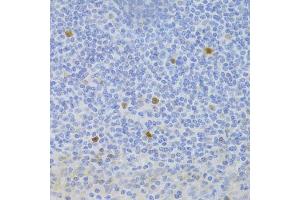 Immunohistochemistry of paraffin-embedded human tonsil using FCN1 Antibody (ABIN2562567) at dilution of 1:100 (40x lens). (FCN1 抗体)