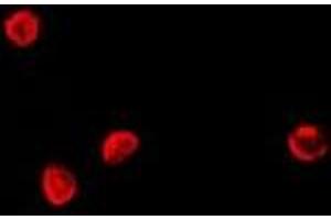 Immunofluorescent analysis of TCF4 staining in Hela cells. (TCF4 抗体)