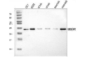 Western blot analysis of HIP2/LIG/UBE2K using anti-HIP2/LIG/UBE2K antibody (ABIN7601341). (UBE2K 抗体  (AA 33-195))
