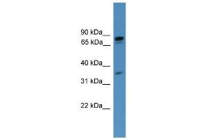 WB Suggested Anti-PDE8A Antibody Titration: 0. (PDE8A 抗体  (C-Term))
