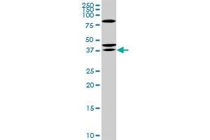 RDHE2 monoclonal antibody (M01), clone 3G8. (SDR16C5 抗体  (AA 26-309))