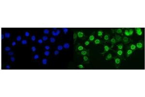 anti-Suppressor of Variegation 3-9 Homolog 2 (Drosophila) (SUV39H2) (AA 6-410) antibody