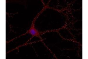 Indirect immunostaining of methanol fixed hippocampus neurons (dilution 1 : 500; red). (RAB5 抗体  (AA 1-215))
