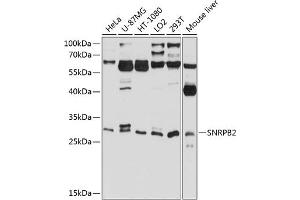 Western blot analysis of extracts of various cell lines, using SNRPB2 antibody (ABIN6132758, ABIN6148216, ABIN6148217 and ABIN6224824) at 1:1000 dilution. (SNRPB2 抗体  (AA 1-150))