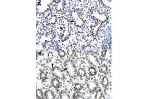 Immunohistochemical staining (Formalin-fixed paraffin-embedded sections) of human lung (A) and human kidney (B) with HEY1 polyclonal antibody  at 4-8 ug/mL working concentration. (HEY1 抗体  (C-Term))