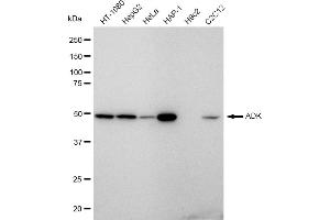 anti-Adenosine Kinase (ADK) antibody