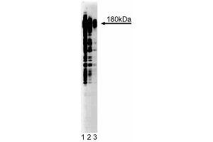 Western blot analysis of Phosphotyrosine on A431 lysate. (Phosphotyrosine 抗体)