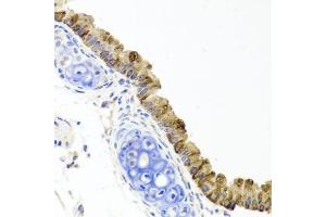 Immunohistochemistry of paraffin-embedded mouse lung using TOPBP1 antibody (ABIN6134114, ABIN6149397, ABIN6149400 and ABIN6216254) at dilution of 1:100 (40x lens). (TOPBP1 抗体  (AA 1-100))