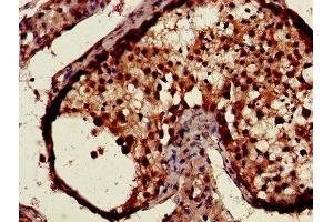Immunohistochemistry of paraffin-embedded human testis tissue using ABIN7146852 at dilution of 1:100 (CSNK1A1 抗体  (Isoform alpha))