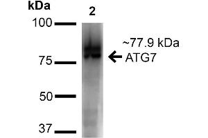 Western blot analysis of Human Cervical Cancer cell lysates (HeLa) showing detection of ~77. (ATG7 抗体  (N-Term))