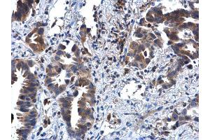 Immunohistochemistry (IHC) image for anti-Interleukin 1 Receptor, Type II (IL1R2) antibody (ABIN2856630)