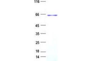 Validation with Western Blot (ZBTB34 Protein (His tag))